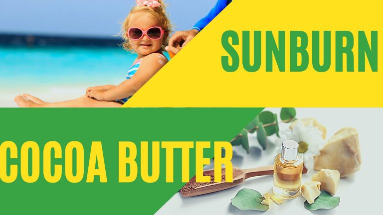 The Cocoa Butter for Sunburns: Your Guide to Relief
